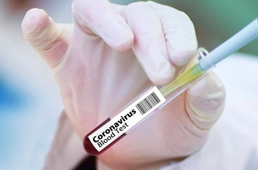  Une étude révèle qu’une dose de vaccin suffirait à protéger les personnes qui ont déjà contracté le Covid-19